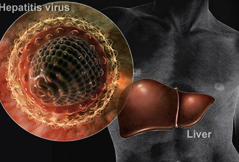 hepatitis-a-virus